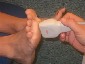 Ultrasound of the foot